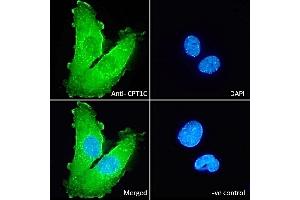 (ABIN570939) Immunofluorescence analysis of paraformaldehyde fixed U251 cells, permeabilized with 0.