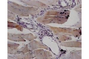 Expression of RyR1 in rat skeletal muscle - Immunohistochemical staining of paraffin embedded sections of rat quadriceps using Anti-Ryanodine Receptor 1 Antibody (ABIN7043604, ABIN7045211 and ABIN7045212), (1:100). (RYR1 Antikörper  (Intracellular))