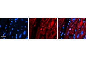 Rabbit Anti-MRPS15 Antibody    Formalin Fixed Paraffin Embedded Tissue: Human Adult heart  Observed Staining: Nuclear, Cytoplasmic Primary Antibody Concentration: 1:600 Secondary Antibody: Donkey anti-Rabbit-Cy2/3 Secondary Antibody Concentration: 1:200 Magnification: 20X Exposure Time: 0.