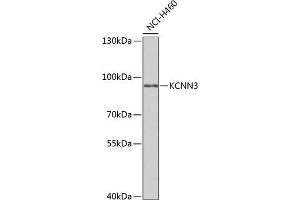 Western blot analysis of extracts of NCI-H460 cells, using KCNN3 antibody (ABIN6131840, ABIN6142769, ABIN6142771 and ABIN6221723) at 1:1000 dilution. (KCNN3 Antikörper  (AA 237-426))