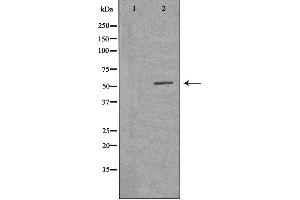 Western blot analysis of extracts from Jurkat cells, using VRK2 antibody. (VRK2 Antikörper  (Internal Region))