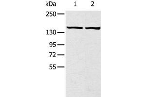 Western Blot analysis of Hela and hepg2 cell using TBC1D4 Polyclonal Antibody at dilution of 1:320 (TBC1D4 Antikörper)