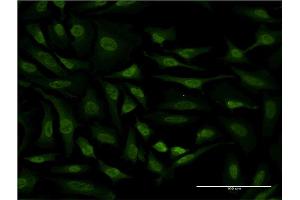 Immunofluorescence (IF) image for anti-Ribosomal Protein S6 Kinase, 90kDa, Polypeptide 6 (RPS6KA6) (AA 636-745) antibody (ABIN565376)