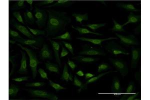 Immunofluorescence of monoclonal antibody to RPS6KA6 on HeLa cell. (RPS6KA6 Antikörper  (AA 636-745))