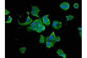Immunofluorescence staining of MCF-7 cells with ABIN7154923 at 1:66, counter-stained with DAPI. (HSP9AB1 (AA 150-355) Antikörper)