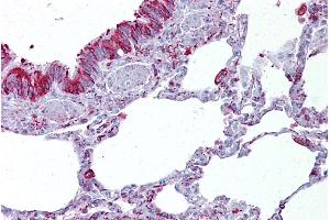 Immunohistochemistry with Lung tissue at an antibody concentration of 5µg/ml using anti-GABRB3 antibody (ARP35339_P050) (GABRB3 Antikörper  (Middle Region))