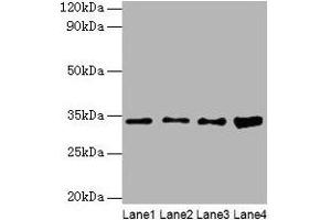 Western blot All lanes: GTF2E2 antibody at 2 μg/mL Lane 1: Mouse brain tissue Lane 2: Hela whole cell lysate Lane 3: MCF-7 whole cell lysate Lane 4: PC-3 whole cell lysate Secondary Goat polyclonal to rabbit IgG at 1/10000 dilution Predicted band size: 34 kDa Observed band size: 34 kDa (GTF2E2 Antikörper  (AA 1-291))