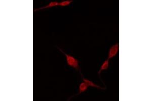 ABIN6274402 staining HuvEc by IF/ICC. (TNFAIP8L2 Antikörper  (Internal Region))
