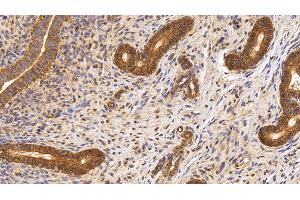 Detection of Surv in Porcine Uterus Tissue using Monoclonal Antibody to Survivin (Surv)