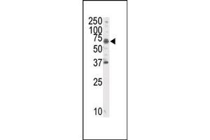 Image no. 1 for anti-RYK Receptor-Like Tyrosine Kinase (RYK) (C-Term) antibody (ABIN359938) (RYK Antikörper  (C-Term))
