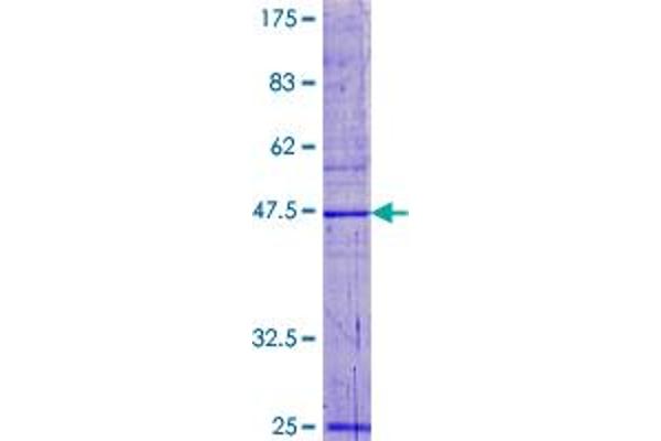 POP5 Protein (AA 1-163) (GST tag)