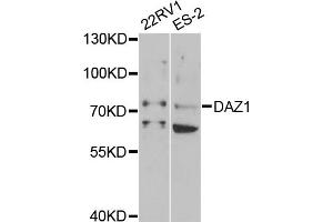 Western blot analysis of extracts of various cell lines, using DAZ1 antibody (ABIN1876498) at 1:1000 dilution. (DAZ1 Antikörper)
