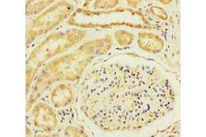 Immunohistochemistry of paraffin-embedded human kidney tissue using ABIN7172224 at dilution of 1:100 (TM2D3 Antikörper  (AA 31-153))