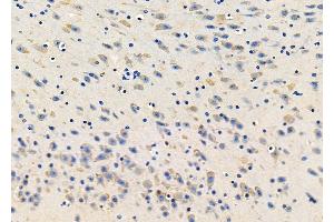 ABIN6265432 and ABIN6278417 at 1/100 staining Mouse brain tissue by IHC-P. (TACR2 Antikörper  (C-Term))