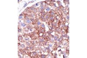 Image no. 2 for anti-SMAD Specific E3 Ubiquitin Protein Ligase 1 (SMURF1) (C-Term) antibody (ABIN357470)