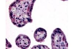 Immunohistochemistry (IHC) image for anti-Solute Carrier Family 7 (Cationic Amino Acid Transporter, Y+ System), Member 5 (SLC7A5) (Internal Region) antibody (ABIN2469355)