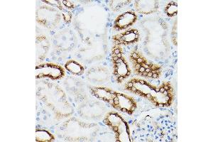 Immunohistochemistry of paraffin-embedded mouse kidney using α-Tubulin Mouse mAb (ABIN7271035) at dilution of 1:100 (40x lens). (TUBA4A Antikörper)