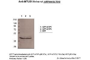 Image no. 2 for anti-Microtubule Associated Tumor Suppressor 1 (MTUS1) (N-Term) antibody (ABIN2781854) (MTUS1 Antikörper  (N-Term))