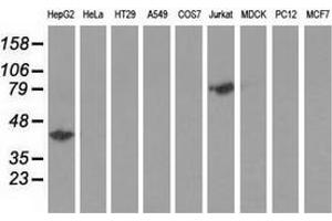 Western blot analysis of extracts (35 µg) from 9 different cell lines by using anti-HP monoclonal antibody. (Haptoglobin Antikörper)