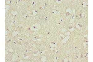 Immunohistochemistry of paraffin-embedded human brain tissue using ABIN7145556 at dilution of 1:100 (BFAR Antikörper  (AA 1-140))
