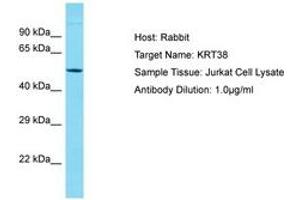 Image no. 1 for anti-Keratin 38 (KRT38) (AA 94-143) antibody (ABIN6750575) (KRT38 Antikörper  (AA 94-143))