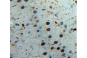 Used in DAB staining on fromalin fixed paraffin-embedded Brain tissue (IL-33 Antikörper  (AA 1-270))