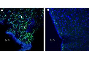 Expression of C3aR1 in mouse hypothalamus. (C3AR1 Antikörper  (Extracellular))