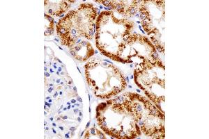 (ABIN390207 and ABIN2840690) staining DDIT4 in human kidney tissue sections by Immunohistochemistry (IHC-P - paraformaldehyde-fixed, paraffin-embedded sections). (DDIT4 Antikörper  (N-Term))
