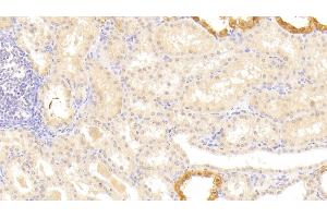 Detection of LAMb3 in Human Kidney Tissue using Polyclonal Antibody to Laminin Beta 3 (LAMb3) (Laminin beta 3 Antikörper  (AA 352-587))