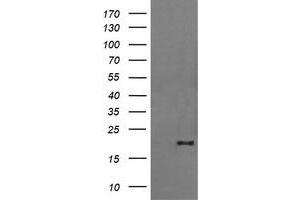 Image no. 2 for anti-Fetal and Adult Testis Expressed 1 (FATE1) antibody (ABIN1498226) (FATE1 Antikörper)