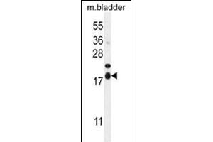 F162A Antibody (C-term) (ABIN654943 and ABIN2844584) western blot analysis in mouse bladder tissue lysates (35 μg/lane). (F162A Antikörper  (C-Term))