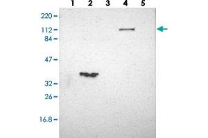 Western blot analysis of Lane 1: RT-4, Lane 2: U-251 MG, Lane 3: Human Plasma, Lane 4: Liver, Lane 5: Tonsil with FAM65A polyclonal antibody  at 1:250-1:500 dilution. (FAM65A Antikörper)