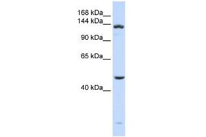 WB Suggested Anti-ADAMTS18 Antibody Titration: 0.