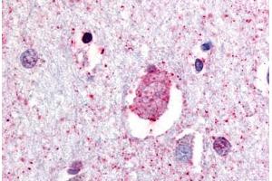 Anti-GPR88 antibody  ABIN1048892 IHC staining of human brain, neurons and glia. (GPR88 Antikörper  (C-Term))
