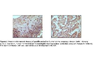 Image no. 1 for anti-Retinoblastoma Protein (Rb Protein) antibody (ABIN205594) (Retinoblastoma Protein (Rb) Antikörper)