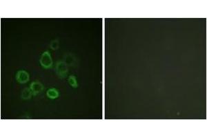 Immunofluorescence analysis of HuvEc cells, using Bax (Ab-167) Antibody. (BAX Antikörper  (AA 133-182))