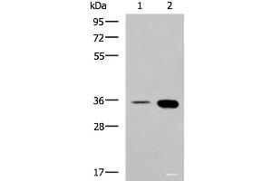 Western blot analysis of HepG2 cell and Mouse brain tissue lysates using MAF Polyclonal Antibody at dilution of 1:550 (MAF Antikörper)