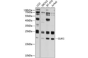 Western blot analysis of extracts of various cell lines, using GUK1 antibody (ABIN6133522, ABIN6141539, ABIN6141540 and ABIN6224743) at 1:1000 dilution. (GUK1 Antikörper  (AA 1-197))