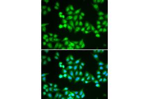 Immunofluorescence analysis of HeLa cells using CHD2 antibody. (CHD2 Antikörper)