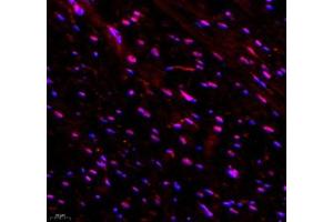 Immunofluorescence (Paraffin-embedded Sections) (IF (p)) image for anti-tRNA-YW Synthesizing Protein 1 Homolog B (S. Cerevisiae) (TYW1B) antibody (ABIN7076025)
