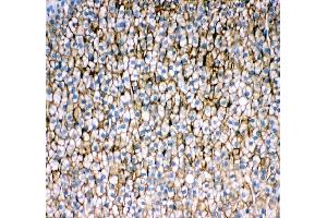 IHC analysis of SCARB1 using anti-SCARB1 antibody (ABIN3043322).