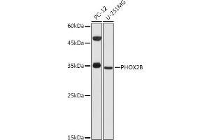 Western blot analysis of extracts of various cell lines, using PHOX2B antibody (ABIN6132489, ABIN6145577, ABIN6145578 and ABIN6225067) at 1:1000 dilution. (PHOX2B Antikörper  (AA 1-90))