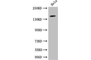 Western Blot Positive WB detected in: Hela whole cell lysate All lanes: TNRC6C antibody at 3. (TNRC6C Antikörper  (AA 157-421))