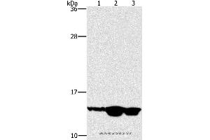 Western blot analysis of Mouse skin tissue, human fetal liver and fetal brain tissue, using HES5 Polyclonal Antibody at dilution of 1:100 (HES5 Antikörper)