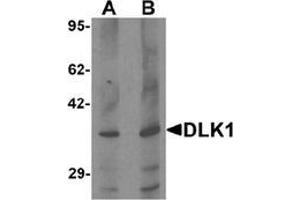 Western blot analysis of HepG2 in 293 cell lysate with DLK1 Antibody  at (A) 1 and (B) 2 μg/ml. (DLK1 Antikörper  (C-Term))