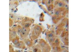 IHC-P analysis of Liver tissue, with DAB staining. (AGT Antikörper  (AA 25-477))