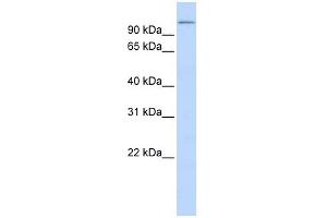 TXNDC16 antibody used at 1 ug/ml to detect target protein. (TXNDC16 Antikörper  (N-Term))