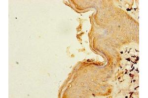 Immunohistochemistry (IHC) image for anti-UDP-GlcNAc:BetaGal beta-1,3-N-Acetylglucosaminyltransferase 2 (B3GNT2) (AA 29-397) antibody (ABIN7160694)
