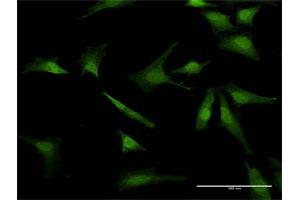 Immunofluorescence (IF) image for anti-Baculoviral IAP Repeat-Containing 5 (BIRC5) (AA 1-142) antibody (ABIN947570)