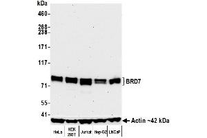 Western Blotting (WB) image for anti-Bromodomain Containing 7 (BRD7) (AA 601-651) antibody (ABIN7453996)